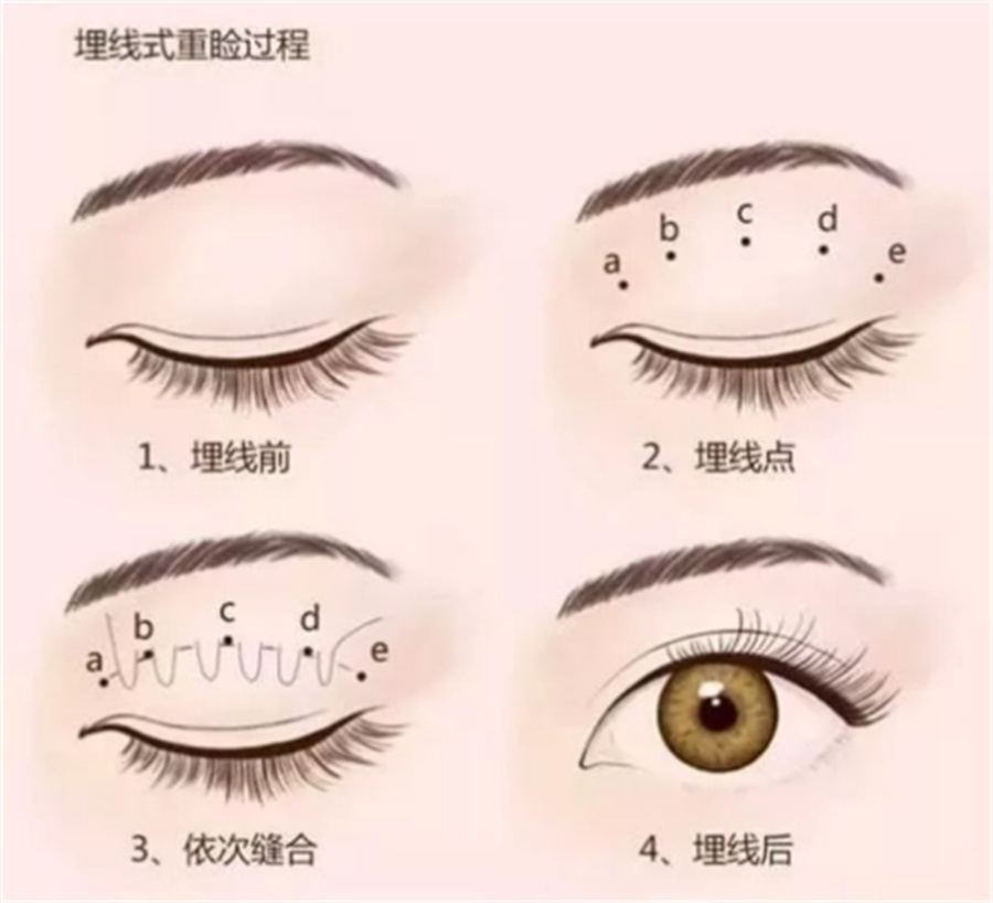 十大眼部微整形师培训机构排名名单一览