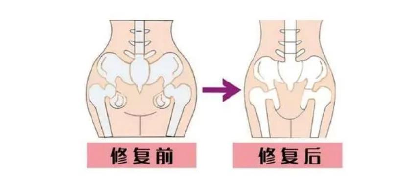 石家庄口碑好的徒手骨盆修复培训机构名单一览
