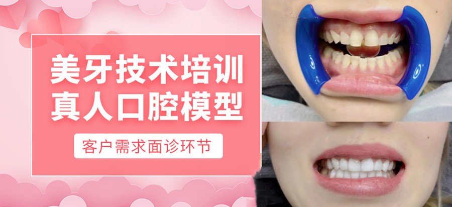 美牙技术培训学校名单甄选