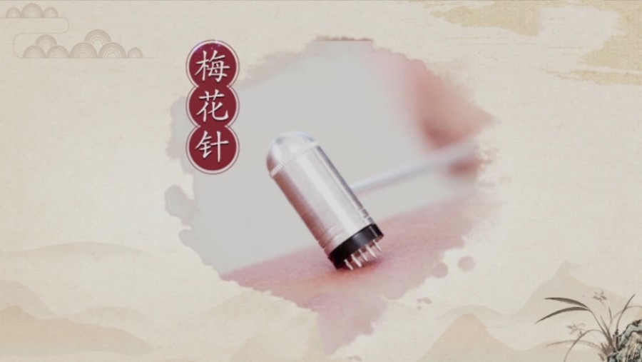 中医刺络放血疗法实操培训机构.jpg