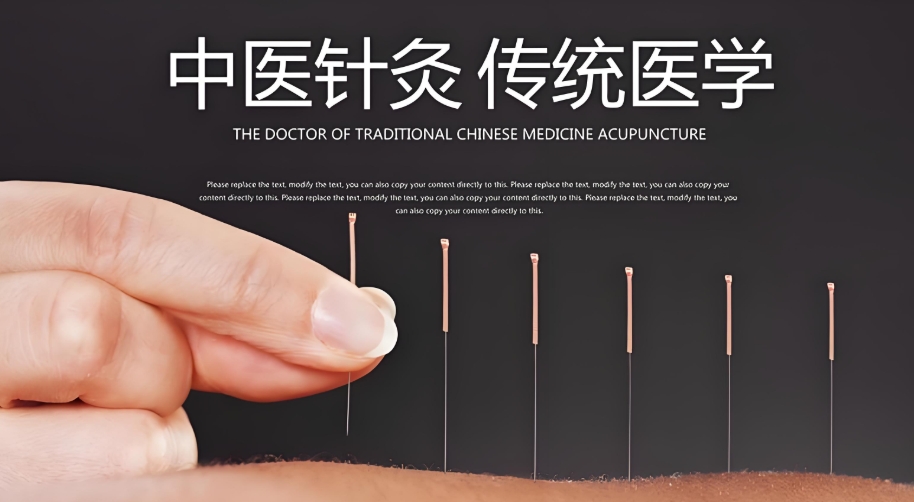 贵州中医针灸技术培训机构10大排行甄选 贵州中医针灸技术培训机构10大排行甄选