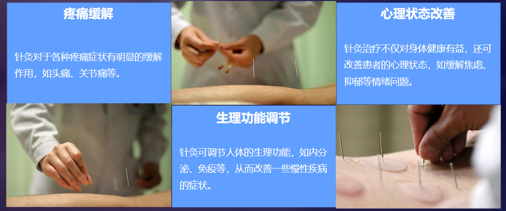 中医针灸培训机构