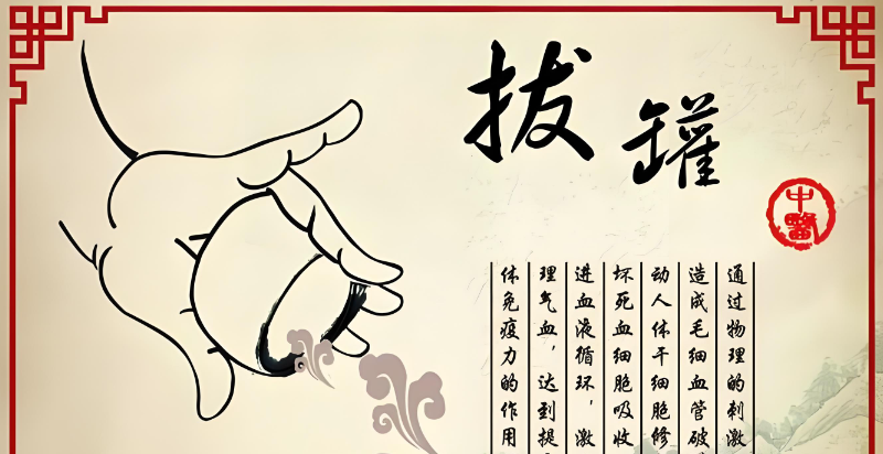 拔罐培训