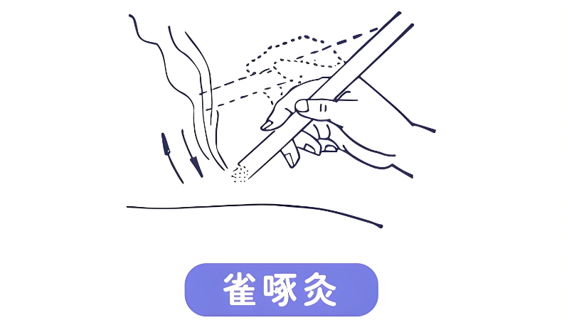 中医针灸 中医针灸